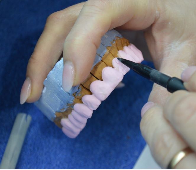 A technician finishing a prosthesis in Creadent's laboratory